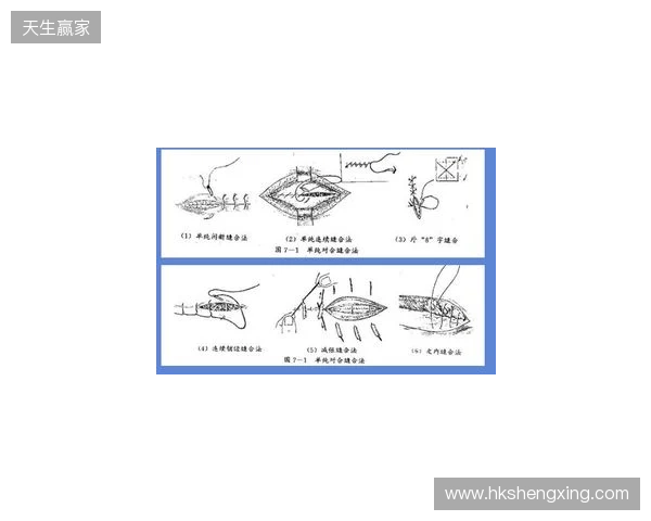 广州豹官方:杨浩眉弓伤口缝合30余针,预计5-7天后拆线